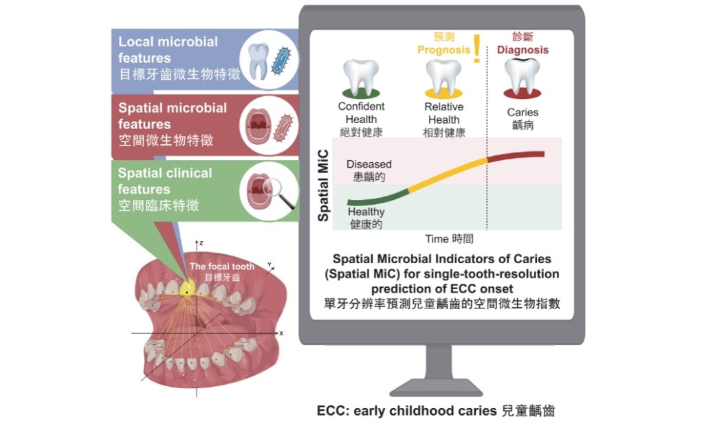 港大牙醫學院全球首創AI系統 預測兒童單齒蛀牙風險逾九成