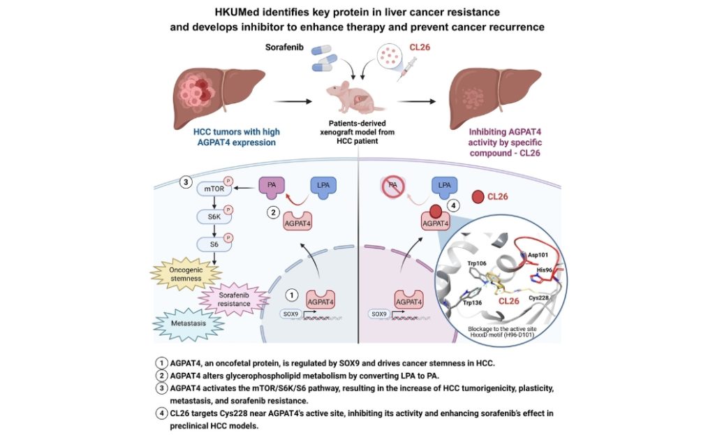 HKUMed Identifies Key Protein in Liver Cancer Resistance and Develops Inhibitor to Enhance Therapy and Prevent Cancer Recurrence