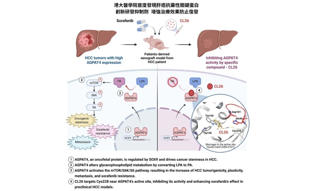 港大醫學院識別肝癌抗藥性關鍵蛋白 研發抑制劑提升療效防復發